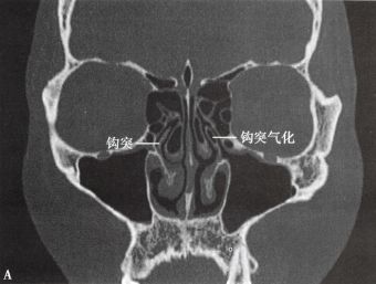 omc是什么意思
