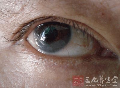 巨婴云襎