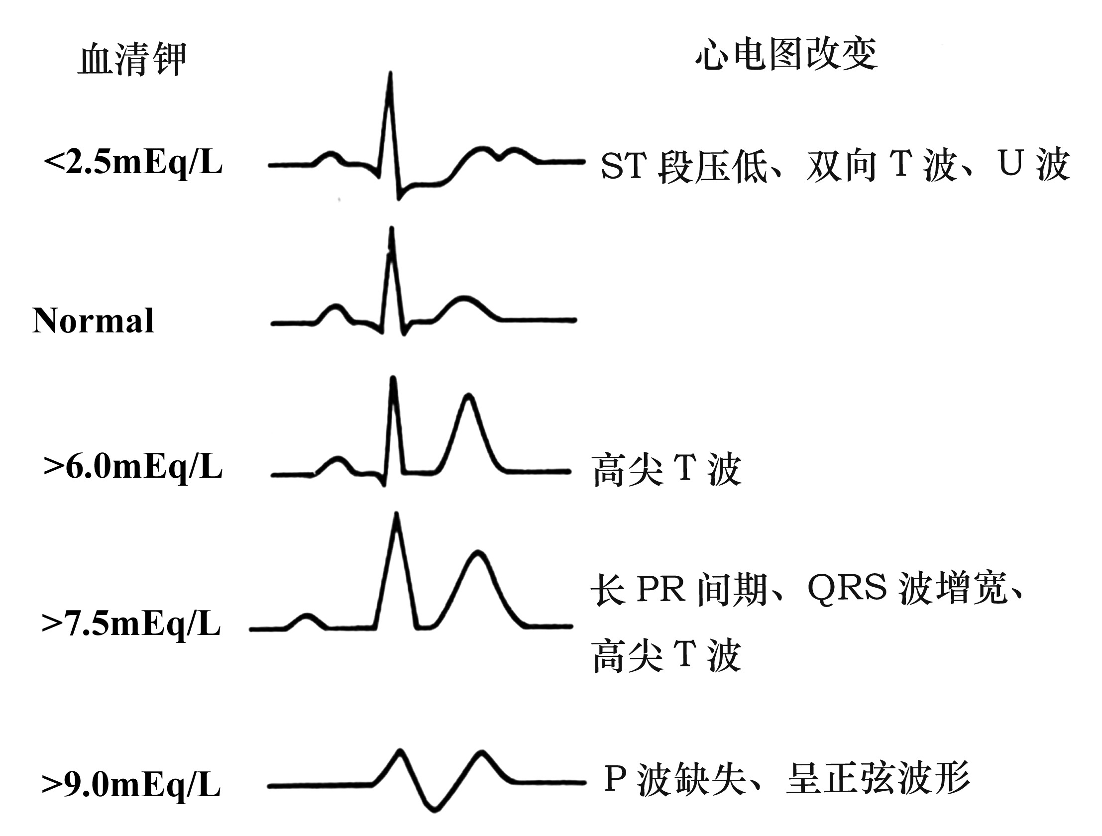 高心