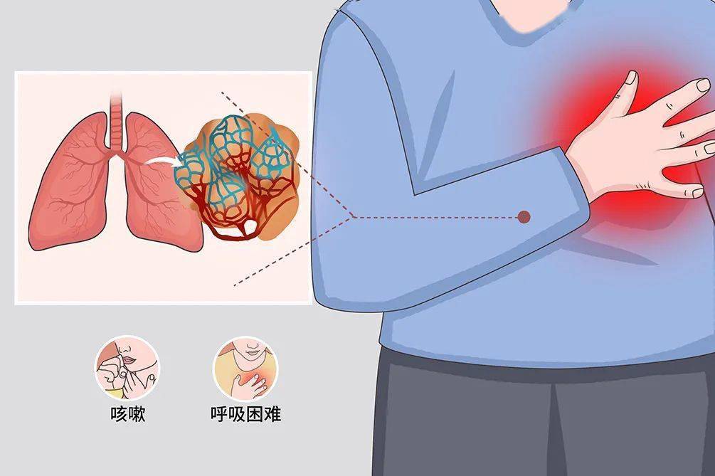 肺窗是什么意思