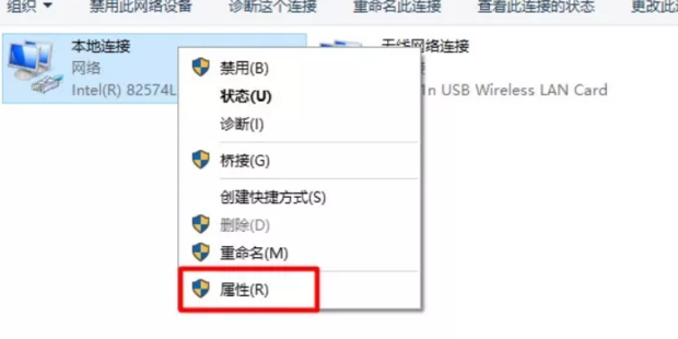 本地网络
