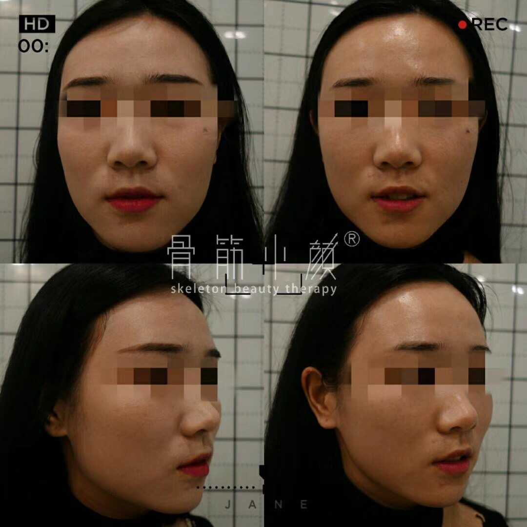小美颜