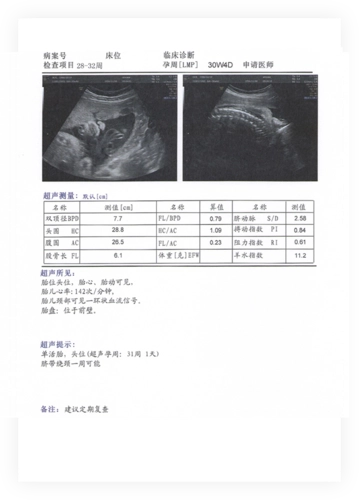 hc是啥