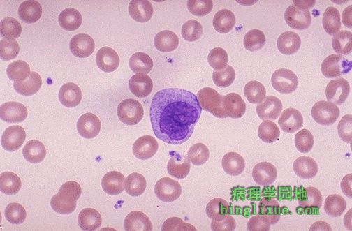单核